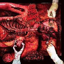 Load image into Gallery viewer, 200 Stab Wounds - Manual Manic Procedures [Ltd Ed Plutonium Green &amp; Yellow Marble Vinyl]
